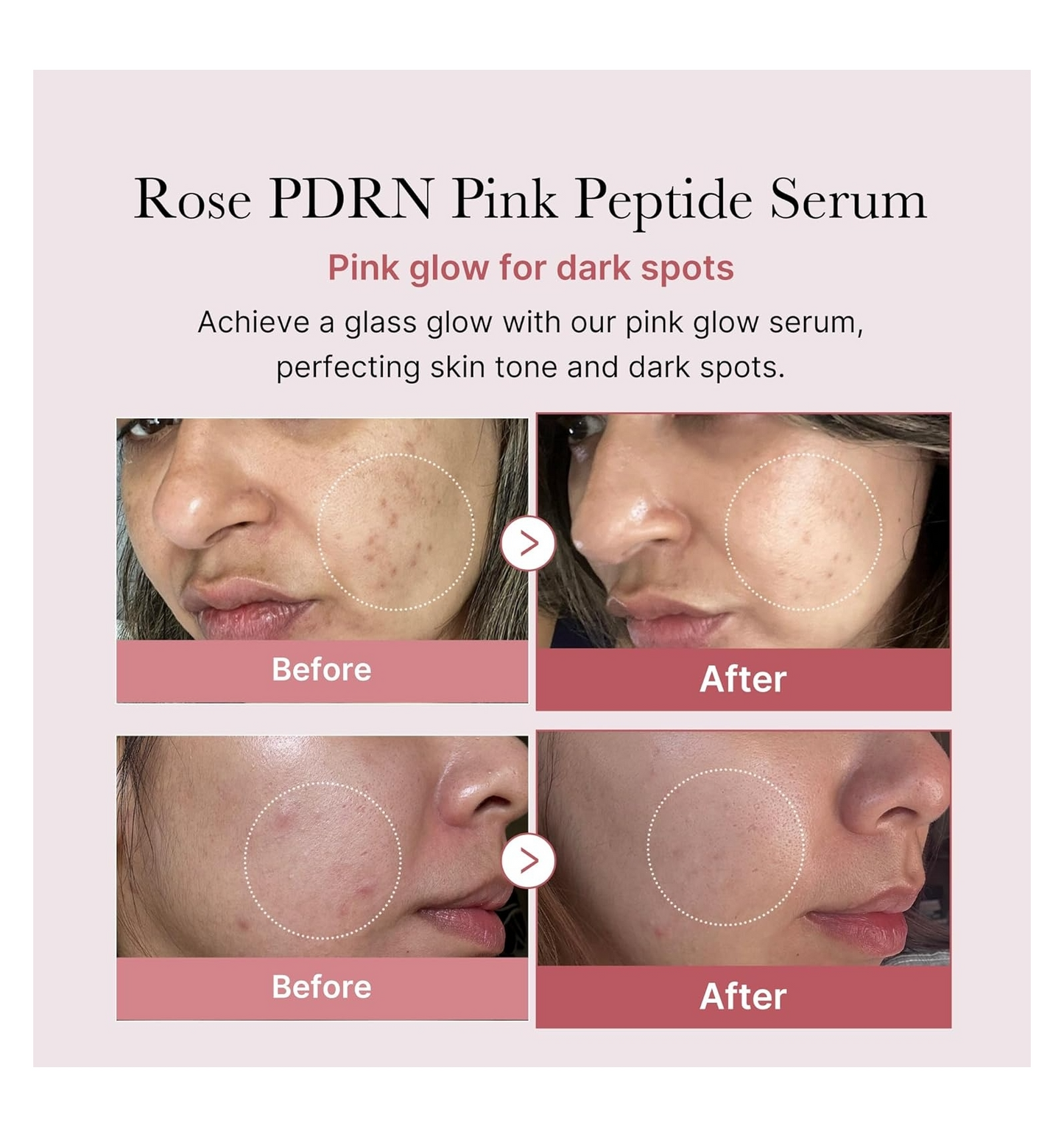 MEDICUBE - PDRN Pink Peptide Serum con ADN de Salmón